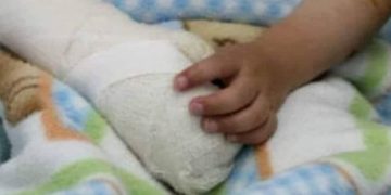 Cachorro de dinamita detona en la mano de un menor en pleno bloqueo