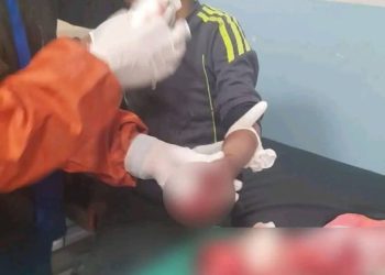 Explosión de petardo deja a un niño sin dedos en el Hospital del Niño de La Paz